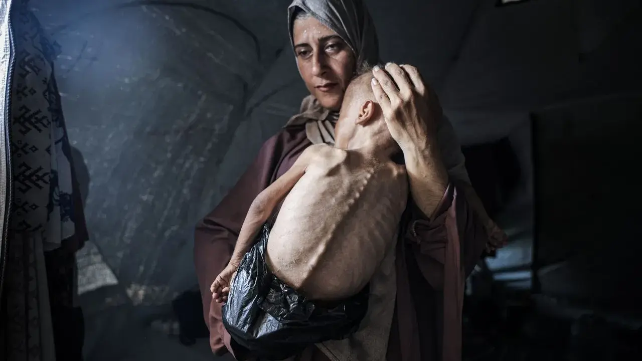 Een moeder troost haar ondervoede kind in een tent. Dit is wat er gebeurt in Gaza: honger en wanhoop.