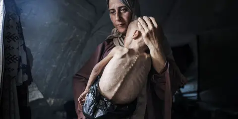 Een moeder troost haar ondervoede kind in een tent. Dit is wat er gebeurt in Gaza: honger en wanhoop.