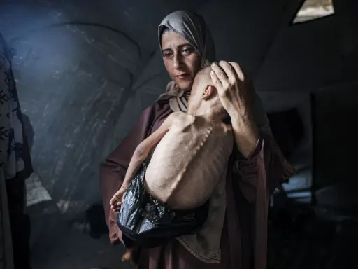 Een moeder troost haar ondervoede kind in een tent. Dit is wat er gebeurt in Gaza: honger en wanhoop.