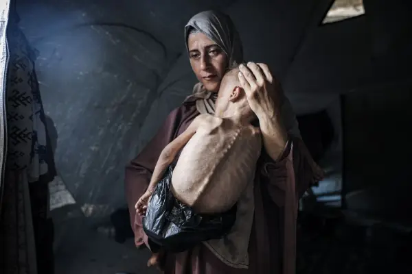 Een moeder troost haar ondervoede kind in een tent. Dit is wat er gebeurt in Gaza: honger en wanhoop.